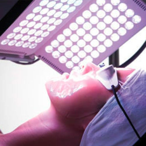 Formation Photothérapie et Biostimulation LED à Lyon